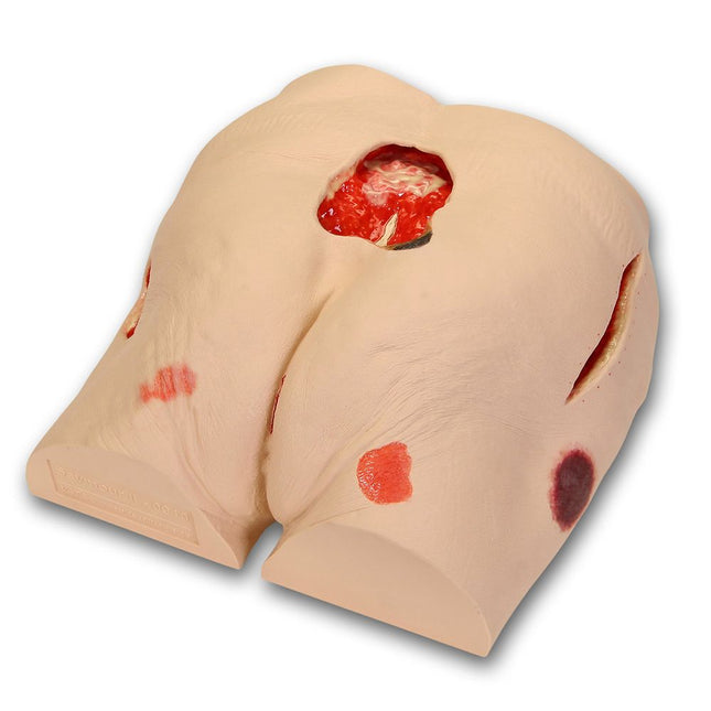 VATA Seymour II Wound Care Model™
